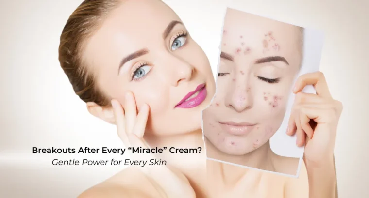 ImpressionZ skincare results – woman with clear, glowing skin holding image of acne-prone face; gentle, effective cream for sensitive skin