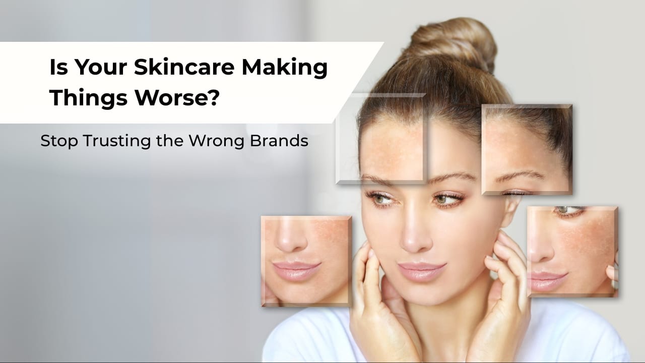 Woman With Damaged, Irritated Skin And Uneven Tone, Skincare Making Things Worse.